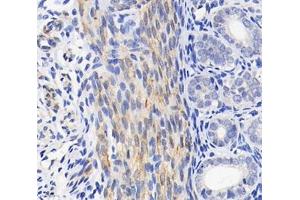 Immunohistochemistry analysis of paraffin-embedded mouse uterus using,TMP1 (ABIN7076030) at dilution of 1: 1600