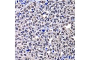 Immunohistochemistry of paraffin-embedded mouse lung cancer using macroH2A.
