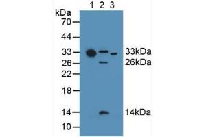 Western blot analysis of (1) Human Serum, (2) Mouse Heart Tissue and (3) Human Liver Tissue. (C1QA anticorps  (AA 28-245))
