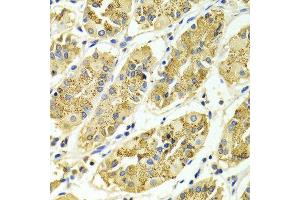 Immunohistochemistry of paraffin-embedded Human gastric using ARHGAP25 antibody at dilution of 1:100 (x400 lens). (ARHGAP25 anticorps  (AA 1-370))
