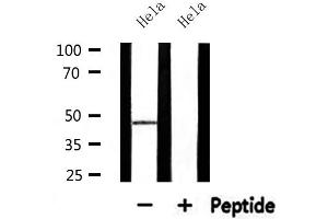 Western blot analysis of extracts from Hela, using ABHD8 Antibody. (ABHD8 anticorps  (Internal Region))