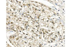 IHC analysis of Slc25a1 using anti-Slc25a1 antibody (ABIN7602839).