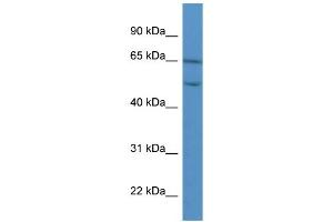 WB Suggested Anti-COL8A2 Antibody Titration: 0.