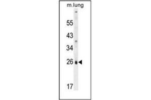 Western blot analysis of PQLC1 Antibody  in mouse lung tissue lysates (35ug/lane).