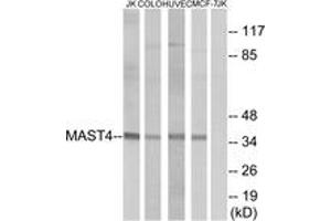 Western blot analysis of extracts from Jurkat/COLO/HuvEc/MCF-7 cells, using MAST4 Antibody. (MAST4 anticorps  (AA 251-300))
