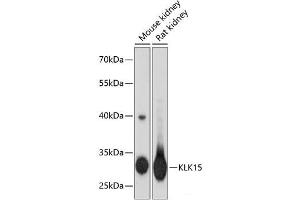 Western blot analysis of extracts of various cell lines using KLK15 Polyclonal Antibody at dilution of 1:3000. (Kallikrein 15 anticorps)