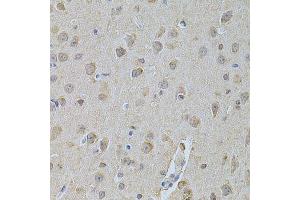 Immunohistochemistry of paraffin-embedded mouse brain using NME1 Antibody. (NME1 anticorps  (C-Term))