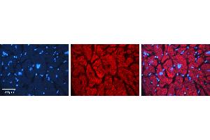 Rabbit Anti-GABARAP Antibody   Formalin Fixed Paraffin Embedded Tissue: Human heart Tissue Observed Staining: Cytoplasmic Primary Antibody Concentration: 1:100 Other Working Concentrations: N/A Secondary Antibody: Donkey anti-Rabbit-Cy3 Secondary Antibody Concentration: 1:200 Magnification: 20X Exposure Time: 0.