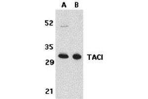 Western Blotting (WB) image for anti-Tumor Necrosis Factor Receptor Superfamily, Member 13B (TNFRSF13B) (N-Term) antibody (ABIN1031600) (TACI anticorps  (N-Term))
