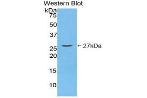 Western Blotting (WB) image for anti-Transforming Growth Factor, beta-Induced, 68kDa (TGFBI) (AA 423-632) antibody (ABIN1860733) (TGFBI anticorps  (AA 423-632))