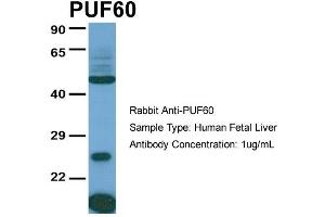 Host:  Rabbit  Target Name:  PUF60  Sample Type:  Human Fetal Liver  Antibody Dilution:  1. (PUF60 anticorps  (C-Term))