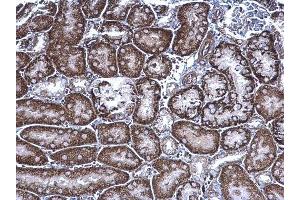 IHC-P Image FRS2 antibody detects FRS2 protein at cytoplasm on mouse kidney by immunohistochemical analysis. (FRS2 anticorps  (Center))