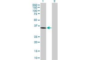 Western Blot analysis of AKR1C1 expression in transfected 293T cell line by AKR1C1 MaxPab polyclonal antibody. (AKR1C1 anticorps  (AA 1-323))