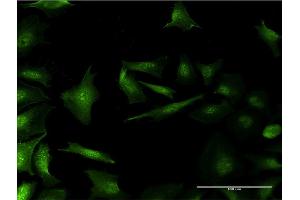 Immunofluorescence of monoclonal antibody to RP2 on HeLa cell. (RP2 anticorps  (AA 251-350))