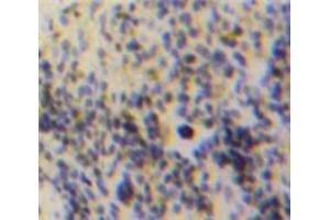 IHC-P analysis of Spleen tissue, with DAB staining.