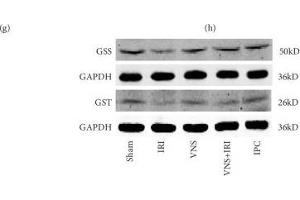 VNS regulated the levels of glutathione and upregulated protein and mRNA levels of glutathione synthetase and glutathione S-transferase. (GST anticorps)