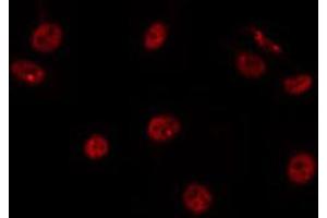 ABIN6266772 staining HepG2 by IF/ICC. (RBAK anticorps  (N-Term))