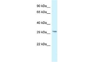 WB Suggested Anti-Gnmt Antibody   Titration: 1. (GNMT anticorps  (N-Term))