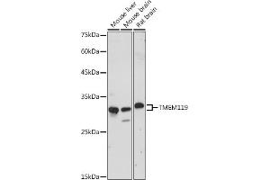 Western blot analysis of extracts of various cell lines, using TMEM119 antibody (ABIN7270953) at 1:1000 dilution. (TMEM119 anticorps)