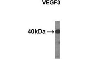 Western Blotting (WB) image for anti-Vascular Endothelial Growth Factor C (VEGFC) (C-Term), (N-Term) antibody (ABIN356356) (VEGFC anticorps  (C-Term, N-Term))