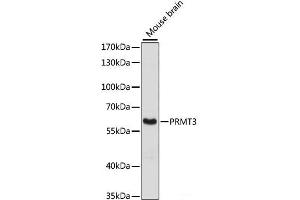 Western blot analysis of extracts of Mouse brain using PRMT3 Polyclonal Antibody at dilution of 1:3000. (PRMT3 anticorps)