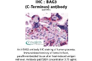Image no. 3 for anti-BCL2-Associated Athanogene 3 (BAG3) (C-Term) antibody (ABIN1732194) (BAG3 anticorps  (C-Term))