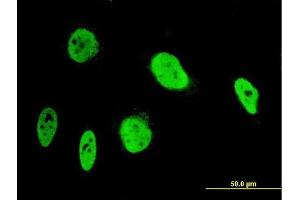 Immunofluorescence of monoclonal antibody to ANKRD17 on HeLa cell. (ANKRD17 anticorps  (AA 2501-2603))