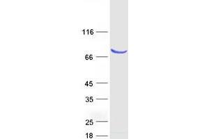 Validation with Western Blot