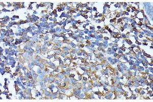 Immunohistochemistry of paraffin-embedded Human colon using CXCR1 Polyclonal Antibody at dilution of 1:100 (40x lens).