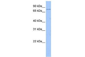 WB Suggested Anti-FOXM1 Antibody Titration:  1 ug/ml  Positive Control:  Jurkat cell lysate (FOXM1 anticorps  (Middle Region))
