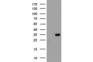 Western Blotting (WB) image for anti-Myeloid Differentiation Primary Response Gene (88) (MYD88) antibody (ABIN1499610) (MYD88 anticorps)