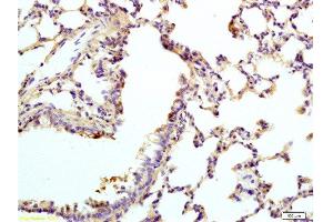 Formalin-fixed and rat lung tissue labeled with Anti-VIP Receptor 1/VAPC1 Polyclonal Antibody, Unconjugated  at 1:200 followed by conjugation to the secondary antibody and DAB staining