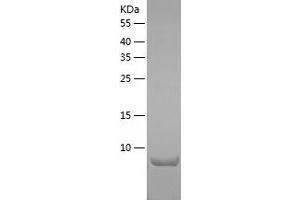 Western Blotting (WB) image for Chemokine (C-C Motif) Ligand 28 (CCL28) (AA 20-130) protein (His-IF2DI Tag) (ABIN7122296)