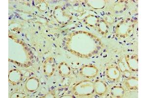 Immunohistochemistry of paraffin-embedded human kidney tissue using ABIN7170991 at dilution of 1:100 (SOCS1 anticorps  (AA 1-211))