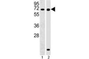Western blot testing of RBPJ antibody at 1:2000 dilution and 1) Ramos, 2) human pancreas lysate