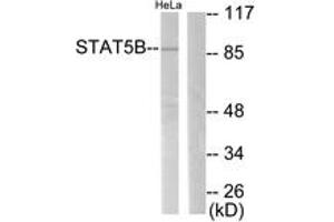 Western Blotting (WB) image for anti-Signal Transducer and Activator of Transcription 5B (STAT5B) (AA 697-746) antibody (ABIN2888609) (STAT5B anticorps  (AA 697-746))