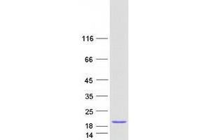 Validation with Western Blot
