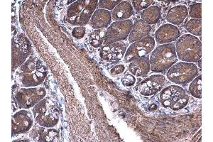 IHC-P Image RPSA antibody [N1C3] detects RPSA protein at cytoplasm on mouse small intestine by immunohistochemical analysis. (RPSA/Laminin Receptor anticorps)