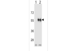 Western blot analysis of ALDH3B1 using rabbit polyclonal ALDH3B1 Antibody using 293 cell lysates (2 ug/lane) either nontransfected (Lane 1) or transiently transfected (Lane 2) with the ALDH3B1 gene.