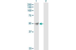 Western Blot analysis of DLST expression in transfected 293T cell line by DLST MaxPab polyclonal antibody.