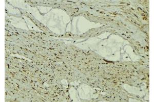 ABIN6277334 at 1/100 staining Mouse muscle tissue by IHC-P. (FBXO32 anticorps  (N-Term))