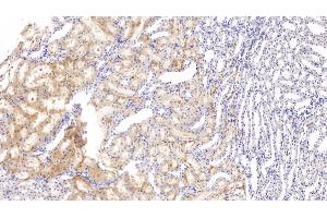 Detection of FXR in Rat Kidney Tissue using Polyclonal Antibody to Farnesoid X Receptor (FXR) (NR1H4 anticorps  (AA 375-568))