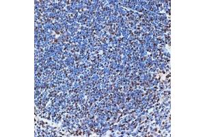 Immunohistochemistry of paraffin-embedded mouse spleen using SET/T Rabbit mAb (ABIN7270265) at dilution of 1:100 (40x lens).