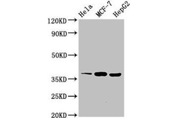 ALX1 Antikörper  (AA 10-304)