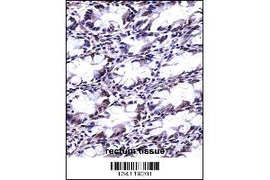 CFL2 Antibody immunohistochemistry analysis in formalin fixed and paraffin embedded human rectum tissue followed by peroxidase conjugation of the secondary antibody and DAB staining.