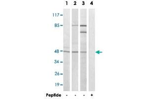 Western blot analysis of extracts from HeLa cells (Lane 1 and lane 4), LoVo cells (Lane 2) and A-549 cells (Lane 3), using FOXB2 polyclonal antibody . (FOXB2 anticorps)