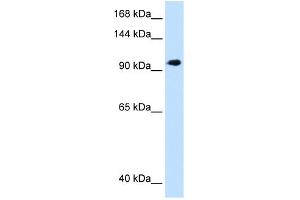 WB Suggested Anti-SEC63 Antibody Titration:  1. (SEC63 anticorps  (C-Term))