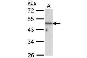 WB Image Sample (30 ug of whole cell lysate) A: Hela 10% SDS PAGE antibody diluted at 1:1000 (Keratin 33B anticorps)
