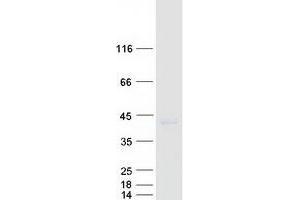 Validation with Western Blot