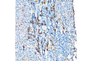 anti-Electron-Transfer-Flavoprotein, alpha Polypeptide (ETFA) (AA 1-333) antibody